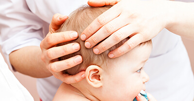 Physio therapist assessing head baby head shape